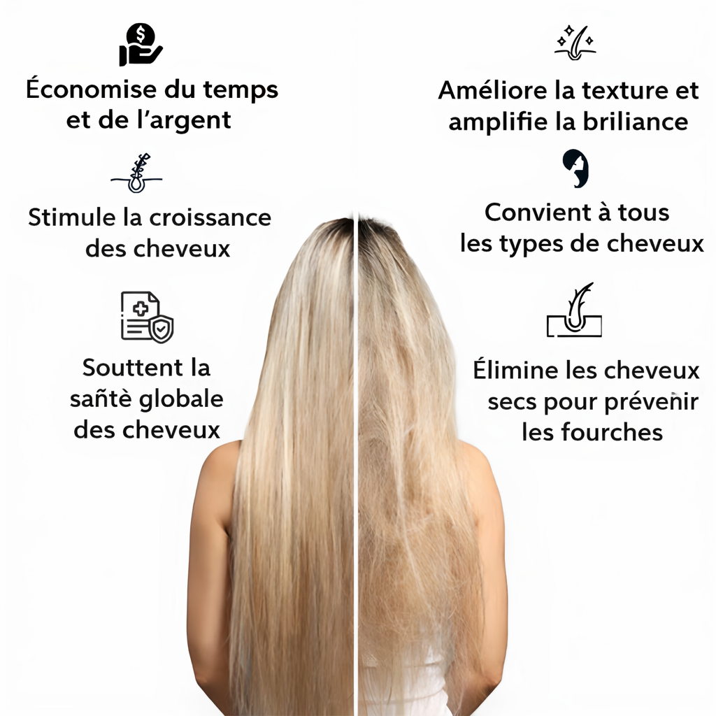 Splity anti-fourches